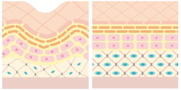 da bị lão hóa da bị lão hóa